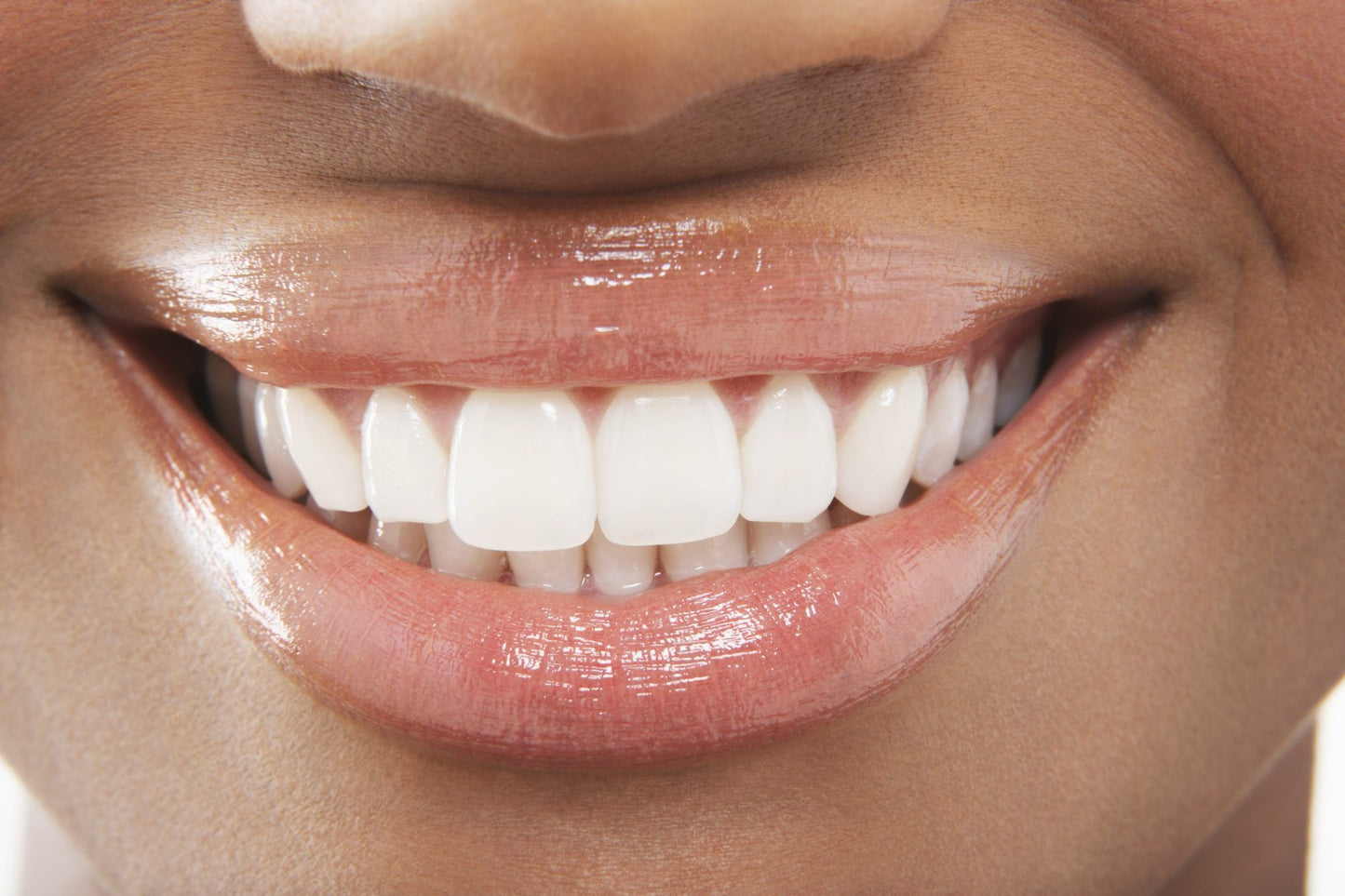Teeth Enhancements